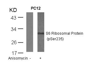 Western blot analysis of extracts from PC12 cells untreated or treated with anisomycin using S6 Ribosomal Protein(Phospho-Ser235) Antibody. Western blot analysis of extracts from PC12 cells untreated or treated with anisomycin using S6 Ribosomal Protein(Phospho-Ser235) Antibody.