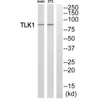 Western blot analysis of extracts from rat brain cells and NIH/3T3 cells, using TLK1 antibody. Western blot analysis of extracts from rat brain cells and NIH/3T3 cells, using TLK1 antibody.