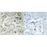 Immunohistochemistry analysis of paraffin-embedded human placenta tissue using CYB5R3 antibody.