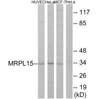 Western blot analysis of extracts from HUVEC cells, HeLa cells and MCF-7cells, using MRPL15 antibody. Western blot analysis of extracts from HUVEC cells, HeLa cells and MCF-7cells, using MRPL15 antibody.