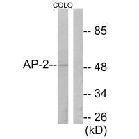 Western blot analysis of extracts from COLO205 cells, using AP-2 antibody. Western blot analysis of extracts from COLO205 cells, using AP-2 antibody.