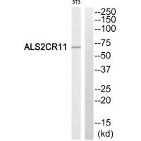 Western blot analysis of extracts from NIH/3T3 cells, using ALS2CR11 antibody. Western blot analysis of extracts from NIH/3T3 cells, using ALS2CR11 antibody.