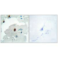 Immunohistochemistry analysis of paraffin-embedded human brain tissue using PTTG antibody.