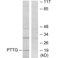 Western blot analysis of extracts from RAW264.7 cells, using PTTG antibody. Western blot analysis of extracts from RAW264.7 cells, using PTTG antibody.