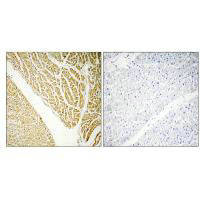 Immunohistochemistry analysis of paraffin-embedded human heart tissue using CABP7 antibody.