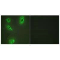 Immunofluorescence analysis of HeLa cells, using BCKD antibody.