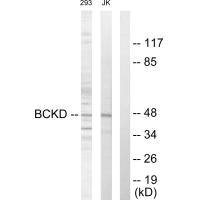 Western blot analysis of extracts from 293 cells and Jurkat cells, using BCKD antibody. Western blot analysis of extracts from 293 cells and Jurkat cells, using BCKD antibody.