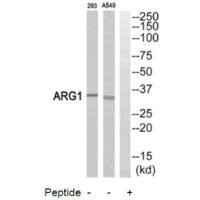 Western blot analysis of extracts from 293 cells and A549 cells, using ARG1antibody. Western blot analysis of extracts from 293 cells and A549 cells, using ARG1antibody.