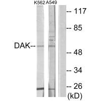 Western blot analysis of extracts from K562 cells and A549 cells, using DAK antibody. Western blot analysis of extracts from K562 cells and A549 cells, using DAK antibody.