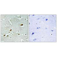 Immunohistochemistry analysis of paraffin-embedded human brain tissue, using TIP60 antibody. Immunohistochemistry analysis of paraffin-embedded human brain tissue, using TIP60 antibody.