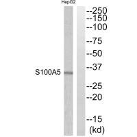 Western blot analysis of extracts from HepG2 cells, using S100A5 antibody. Western blot analysis of extracts from HepG2 cells, using S100A5 antibody.