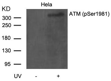 Western blot analysis of extracts from Hela cells untreated or treated with UV using ATM(Phospho-Ser1981) Antibody Western blot analysis of extracts from Hela cells untreated or treated with UV using ATM(Phospho-Ser1981) Antibody