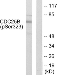 Western blot analysis of extracts from NIH/3T3 cells treated with PMA (125ng/ml, 30mins), using CDC25B (Phospho-Ser323) antibody. The lane on the right is treated with the synthesized peptide. Western blot analysis of extracts from NIH/3T3 cells treated with PMA (125ng/ml, 30mins), using CDC25B (Phospho-Ser323) antibody. The lane on the right is treated with the synthesized peptide.