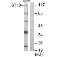 Western blot analysis of extracts from HUVEC cells, using ZNF387 antibody. Western blot analysis of extracts from HUVEC cells, using ZNF387 antibody.