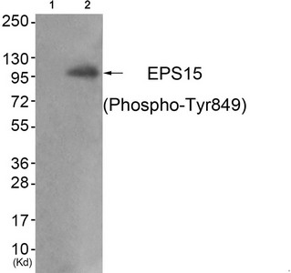 Western blot analysis of extracts from JK cells (Lane 2), using EPS15 (Phospho-Tyr849) Antibody. The lane on the left is treated with antigen-specific peptide. Western blot analysis of extracts from JK cells (Lane 2), using EPS15 (Phospho-Tyr849) Antibody. The lane on the left is treated with antigen-specific peptide.