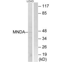 Western blot analysis of extracts from LOVO cells, using MNDA antibody. Western blot analysis of extracts from LOVO cells, using MNDA antibody.