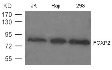 Western blot analysis of extract from JK, Raji and 293 cells using FOXP2 Antibody Western blot analysis of extract from JK, Raji and 293 cells using FOXP2 Antibody