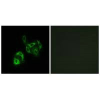Immunofluorescence analysis of A549 cells, using SLC27A4 antibody. Immunofluorescence analysis of A549 cells, using SLC27A4 antibody.