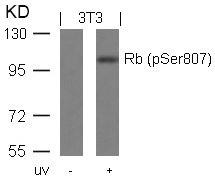 Western blot analysis of extracts from 3T3 cells untreated or treated with UV using Rb(Phospho-Ser807) Antibody. Western blot analysis of extracts from 3T3 cells untreated or treated with UV using Rb(Phospho-Ser807) Antibody.