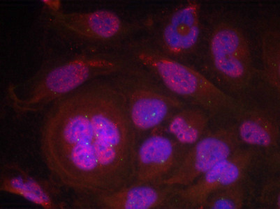Immunofluorescence staining of methanol-fixed Hela cells using NFkappa;B-p65 (Phospho-Ser276) Antibody. Immunofluorescence staining of methanol-fixed Hela cells using NFkappa;B-p65 (Phospho-Ser276) Antibody.