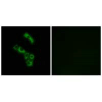 Immunofluorescence analysis of A549 cells, using C1QB antibody.