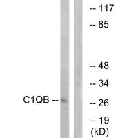 Western blot analysis of extracts from Jurkat cells, using C1QB antibody. Western blot analysis of extracts from Jurkat cells, using C1QB antibody.