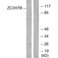 Western blot analysis of extracts from 293 cells, using ZC3H7B antibody. Western blot analysis of extracts from 293 cells, using ZC3H7B antibody.
