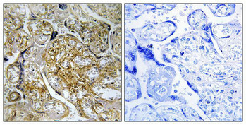 Immunohistochemical analysis of paraffin-embedded human placenta tissue using PAK1/2 (Phospho-Ser199) antibody (left)or the same antibody preincubated with blocking peptide (right).