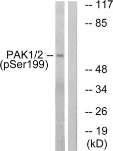 Western blot analysis of extracts from LOVO cells treated with starved using PAK1/2 (Phospho-Ser199) Antibody.The lane on the right is treated with the antigen-specific peptide. Western blot analysis of extracts from LOVO cells treated with starved using PAK1/2 (Phospho-Ser199) Antibody.The lane on the right is treated with the antigen-specific peptide.
