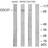 Western blot analysis of extracts from HUVEC cells, HepG2 cells and COLO205 cells, using H-NUC antibody. Western blot analysis of extracts from HUVEC cells, HepG2 cells and COLO205 cells, using H-NUC antibody.