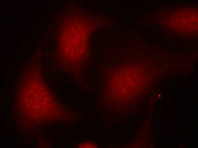 Immunofluorescence staining of methanol-fixed Hela cells using Rb(Phospho-Ser795) Antibody.