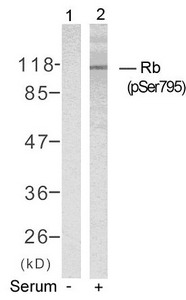 Western blot analysis of extracts from K562 cells untreated(lane 1) or treated with serum(lane 2) using Rb(Phospho-Ser795) Antibody. Western blot analysis of extracts from K562 cells untreated(lane 1) or treated with serum(lane 2) using Rb(Phospho-Ser795) Antibody.