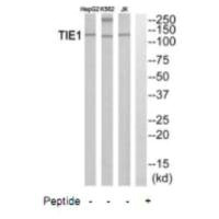 Western blot analysis of extracts from HepG2 cells, K562 cells and Jurkat cells, using TIE1 antibody. Western blot analysis of extracts from HepG2 cells, K562 cells and Jurkat cells, using TIE1 antibody.