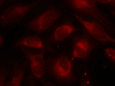 Immunofluorescence staining of methanol-fixed Hela cells using p70 S6 Kinase(Ab-389) Antibody.