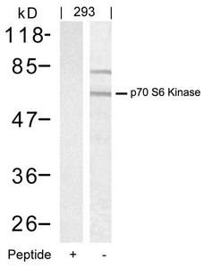 Western blot analysis of extracts from 293 cells using p70 S6 Kinase(Ab-389) Antibody(Lane 2) and the same antibody preincubated with blocking peptide(Lane1). Western blot analysis of extracts from 293 cells using p70 S6 Kinase(Ab-389) Antibody(Lane 2) and the same antibody preincubated with blocking peptide(Lane1).