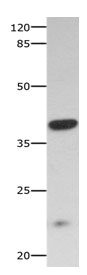 Gel: 10%SDS-PAGE Lysate: 40 ug Mouse skeletal muscle tissue lysate Primary antibody: 1/300 dilution Secondary antibody: Goat anti Rabbit IgG - H&L (HRP) at 1/10000 dilution Exposure time: 60 seconds Gel: 10%SDS-PAGE Lysate: 40 ug Mouse skeletal muscle tissue lysate Primary antibody: 1/300 dilution Secondary antibody: Goat anti Rabbit IgG - H&L (HRP) at 1/10000 dilution Exposure time: 60 seconds
