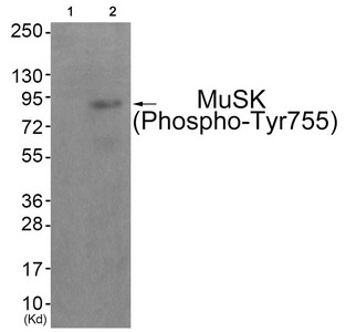 Western blot analysis of extracts from JK cells (Lane 2), using MuSK (Phospho-Tyr755) Antibody. The lane on the left is treated with antigen-specific peptide.