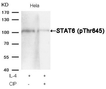 Western blot analysis of extracts from Hela cells, treated with IL-4 or calf intestinal phosphatase (CIP), using STAT6 (Phospho-Thr645) Antibody.
