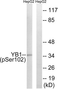 Western blot analysis of extracts from HepG2 cells treated with PMA using YB1 (Phospho-Ser102) Antibody.The lane on the right is treated with the antigen-specific peptide. Western blot analysis of extracts from HepG2 cells treated with PMA using YB1 (Phospho-Ser102) Antibody.The lane on the right is treated with the antigen-specific peptide.