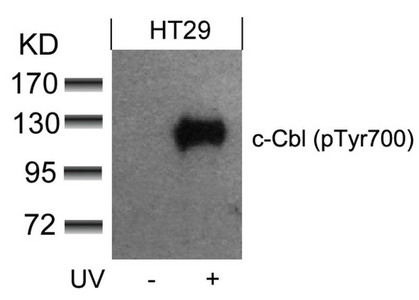 Western blot analysis of extracts from HT29 cells untreated or treated with UV using c-Cbl(phospho-Tyr700) Antibody. Western blot analysis of extracts from HT29 cells untreated or treated with UV using c-Cbl(phospho-Tyr700) Antibody.