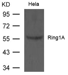 CSB-PA205793