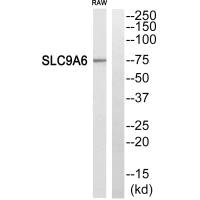 Western blot analysis of extracts from RAW264.7 cells,using SLC9A6 antibody. Western blot analysis of extracts from RAW264.7 cells,using SLC9A6 antibody.