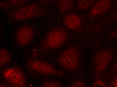Immunofluorescence staining of methanol-fixed MCF7 cells using PKCb(phospho-Thr641) antibody.