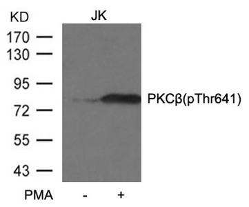 Western blot analysis of extracts from JK cells untreated or treated with PMA using PKCbeta (phospho-Thr641) antibody. Western blot analysis of extracts from JK cells untreated or treated with PMA using PKCbeta (phospho-Thr641) antibody.