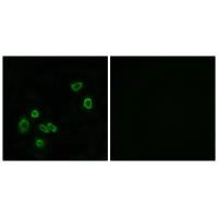 CSB-PA206581