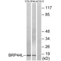 CSB-PA206581