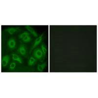 Immunofluorescence analysis of HeLa cells, using CDH23 antibody. Immunofluorescence analysis of HeLa cells, using CDH23 antibody.