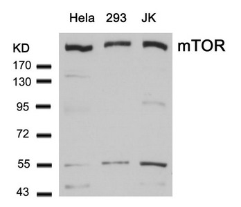 Western blot analysis of extracts from Hela, 293 and JK cells using mTOR(Ab-2448) Antibody. Western blot analysis of extracts from Hela, 293 and JK cells using mTOR(Ab-2448) Antibody.