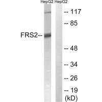 Western blot analysis of extracts from HepG2 cells, using FRS2 (Ab-196) antibody.