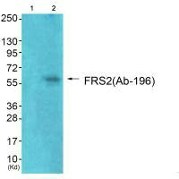 Western blot analysis of extracts from 293 cells (Lane 2), using FRS2 (Ab-196) antiobdy. The lane on the left is treated with synthesized peptide.